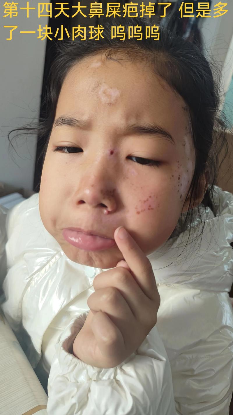 舞蹈艺考脸上有疤可以吗