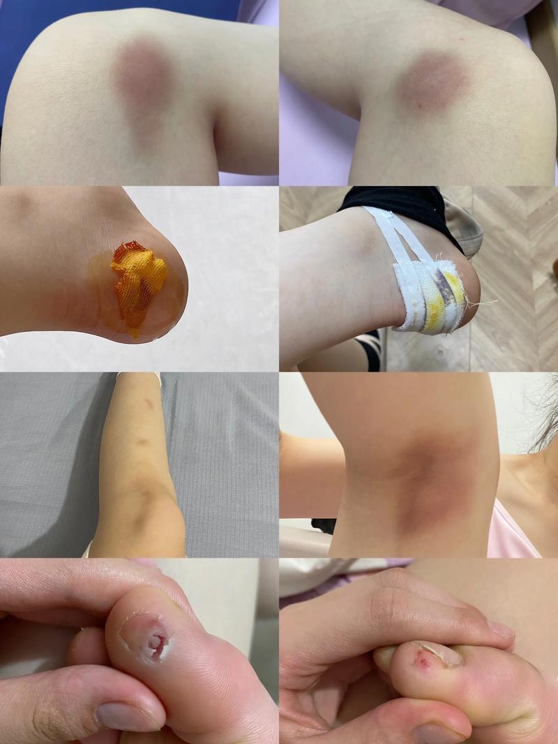 舞蹈艺考脸上有疤可以吗