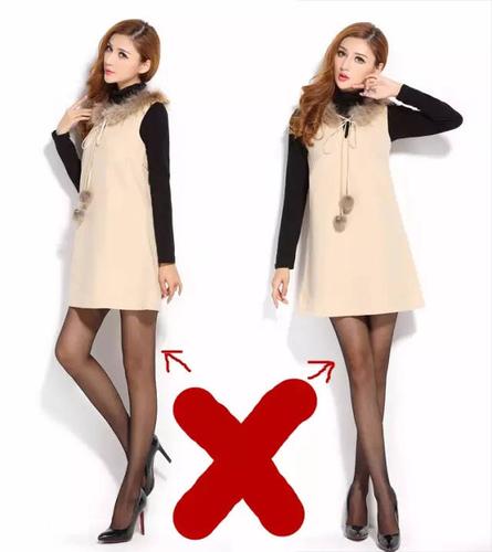 罗圈腿对艺考有影响吗